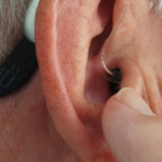 ReSound: The Revolutionary Hearing Aid Redefining Normalcy